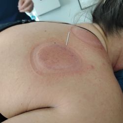 Awakening Balance Acupuncture and Traditional Chinese Medicine