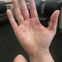 Walk In Urgent Care