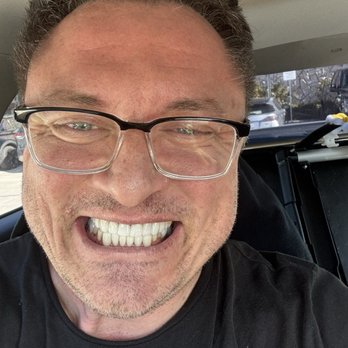 Malibu Canyon Dental - He can't fix this smile I get it it's terrible but focus on the teeth!!! - General Dentistry Near Me - Calabasas, California Malibu Canyon Dental - He can't fix this smile I get it it's terrible but focus on the teeth!!! - General Dentistry Near Me - Calabasas, California