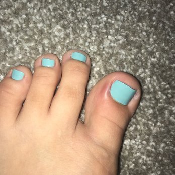 VT Nails & Spa - Infected toe - Nail Salons Near Me - Oak Lawn, Illinois