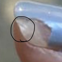 Inspire Nail Boutique - Nail trauma that forced the gel Polish away from nail