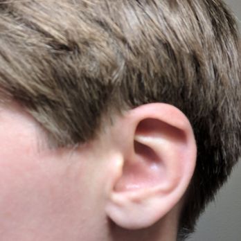 Artisan Salon & Spa - Unfortunate sideburns from a less than fantastic pixie cut. (1/2) - Hair Salons Near Me - Lindon, Utah Artisan Salon & Spa - Unfortunate sideburns from a less than fantastic pixie cut. (1/2) - Hair Salons Near Me - Lindon, Utah