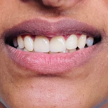 Nitender Kumar - General Dentistry Near Me - Cincinnati, Ohio Nitender Kumar - General Dentistry Near Me - Cincinnati, Ohio