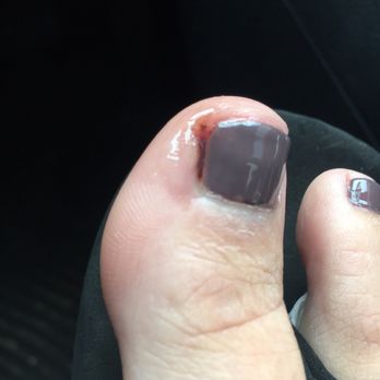 Bella Nails & Spa - 5/29/17 I my I left with my toe bleeding and swollen. No amount of free drinks can cover for bad service. - Nail Salons Near Me - Brea, California