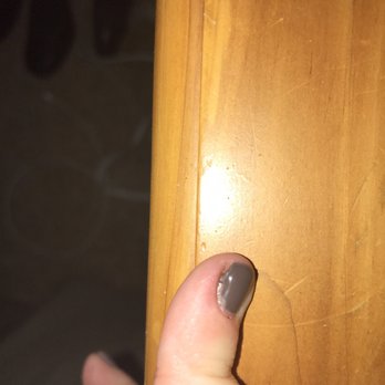 Glamour Nails - Pinky he butchered - Nail Salons Near Me - Crestview Hills, Kentucky