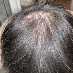Medical Hair Transplant & Aesthetics
