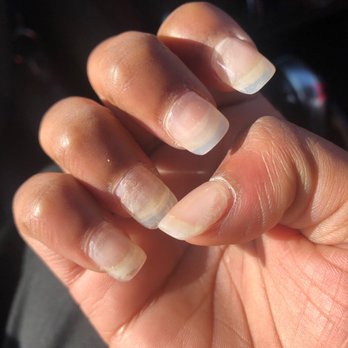 California Nails - They did a horrible job this is after 4 days do not go here - Nail Salons Near Me - Hopewell, Virginia California Nails - They did a horrible job this is after 4 days do not go here - Nail Salons Near Me - Hopewell, Virginia