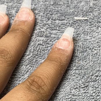 Fashio Nail Spa - They drilled into my nail bed and those red lines are blood vessels - Nail Salons Near Me - Pearland, Texas Fashio Nail Spa - They drilled into my nail bed and those red lines are blood vessels - Nail Salons Near Me - Pearland, Texas