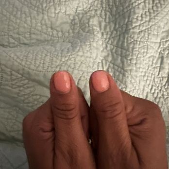 Euphoria Nails & Spa - Side by side thumbs showing the horrible work - Nail Salons Near Me - Ontario, California