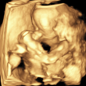 Diablo Valley Perinatal Group - This is the quality of image produced in DVP! Can someone tell me what this is?!!! - Obstetricians & Gynecologists Near Me - Walnut Creek, California Diablo Valley Perinatal Group - This is the quality of image produced in DVP! Can someone tell me what this is?!!! - Obstetricians & Gynecologists Near Me - Walnut Creek, California