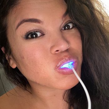 Smile Direct Club - Free teeth whitening system! Bright on! - Cosmetic Dentists Near Me - Brookfield, Wisconsin Smile Direct Club - Free teeth whitening system! Bright on! - Cosmetic Dentists Near Me - Brookfield, Wisconsin