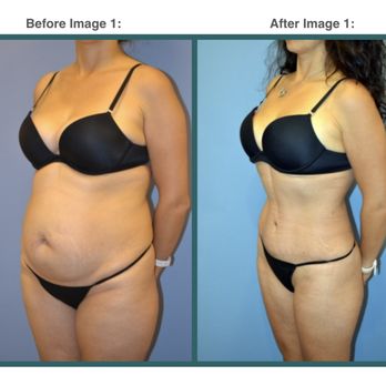 Associates in Plastic Surgery - Contact Us Today for a Consultation: https://www.associatesinplasticsurgery.com/contact-us - Medical Spas Near Me - Edison, New Jersey