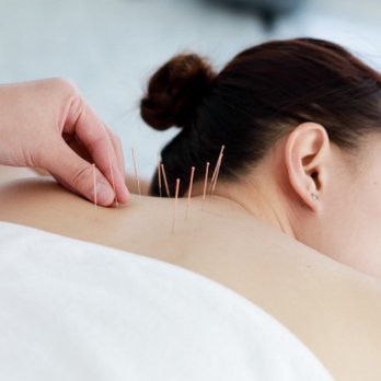 China Acupuncture - Acupuncture Near Me - New York, New York China Acupuncture - Acupuncture Near Me - New York, New York