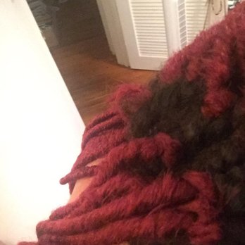 Boss Braids - I don't even know what part of my scalp this is but it looks crazy - Hair Stylists Near Me - Sacramento, California