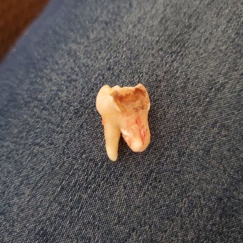 Placentia Oral Surgery - Oral Surgeons Near Me - Placentia, California