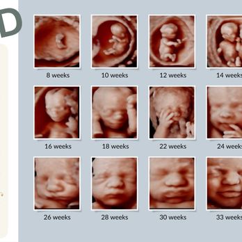 4d Peek a Boo - Diagnostic Imaging Near Me - Pace, Florida 4d Peek a Boo - Diagnostic Imaging Near Me - Pace, Florida