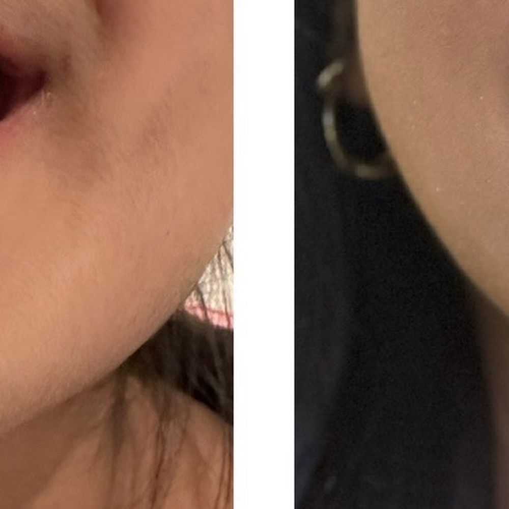 18 months apart 18 months apart