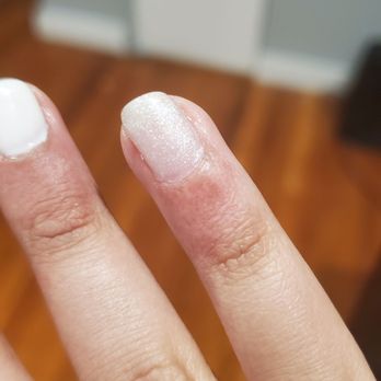 Mayra Nails & Spa - My inflamed cuticles - Nail Salons Near Me - Jamaica, New York Mayra Nails & Spa - My inflamed cuticles - Nail Salons Near Me - Jamaica, New York