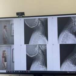 The Drugless Doctors - Neck range and posture