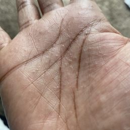 contact dermatitis