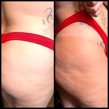 Glow Getter by LC - Before and after with the new Dolce Glow - Tanning Near Me Glow Getter by LC - Before and after with the new Dolce Glow - Tanning Near Me