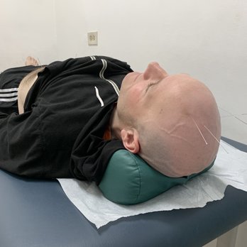 120 Acupuncture Clinic - I had the staff take a photo to show what the pins look like. I can also testify that this pillow is incredibly comfortable. - Acupuncture Near Me - Studio City, California
