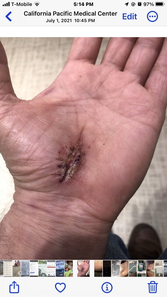 Brian Andrews, MD - patient advocate in San Francisco, CA