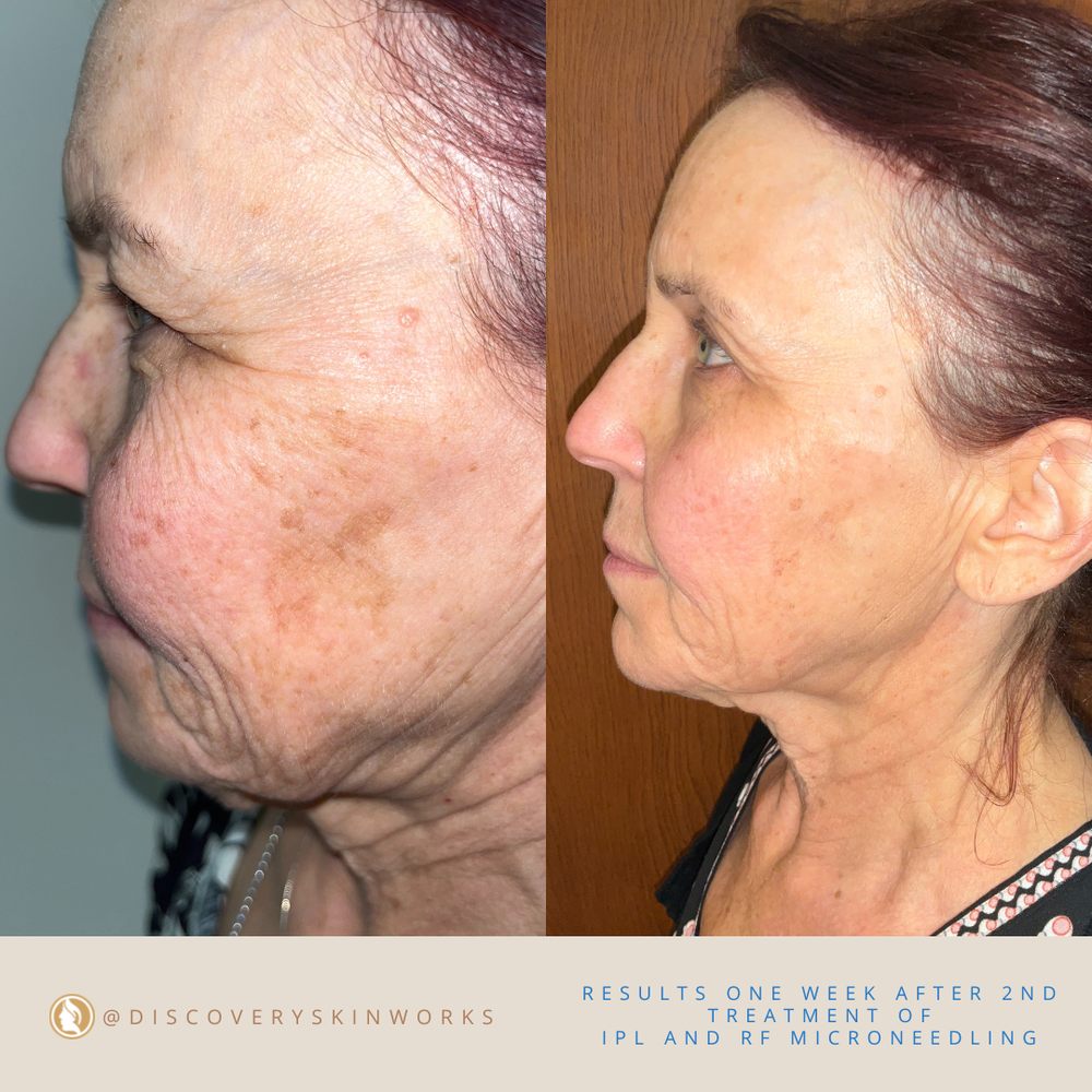 Discovery Skinworks Logo