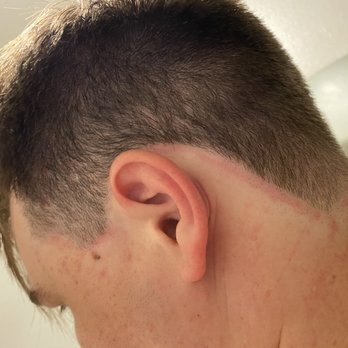 The Garrison - Skin irritation - Barbers Near Me - Las Vegas, Nevada The Garrison - Skin irritation - Barbers Near Me - Las Vegas, Nevada