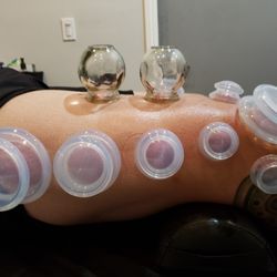 Viable Cupping