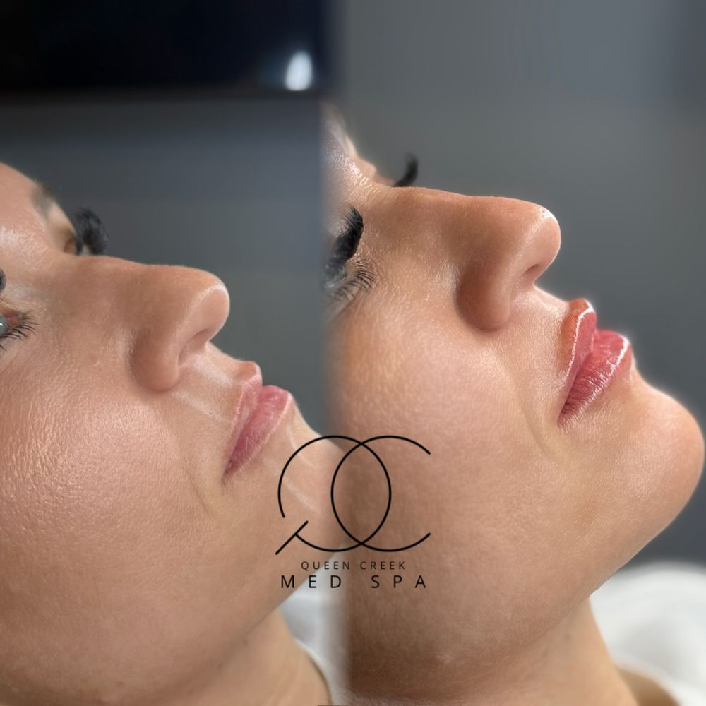 Queen Creek Med spa Logo