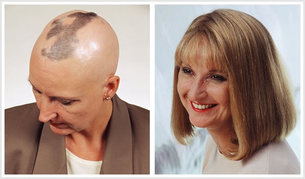 Chris For Hair Logo