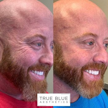 True Blue Aesthetics - Medical Spas Near Me - Edmond, Oklahoma True Blue Aesthetics - Medical Spas Near Me - Edmond, Oklahoma