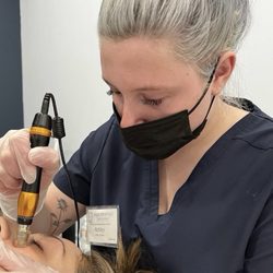 Skin Savior By Ash - Microneedling with the Innopen- zero downtime zero pain!