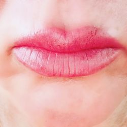 Amethyst Aesthetics Beauty Clinic - Sugar lips