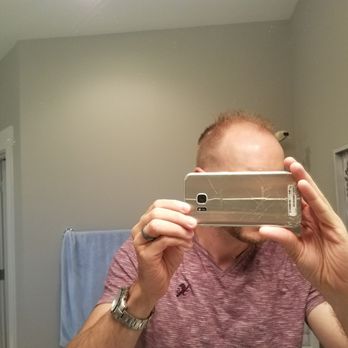 Scout's Barbershop - Head sheared on top instead of just up the sides. No fading done between top and sides. Shameful. - Barbers Near Me - Nashville, Tennessee Scout's Barbershop - Head sheared on top instead of just up the sides. No fading done between top and sides. Shameful. - Barbers Near Me - Nashville, Tennessee