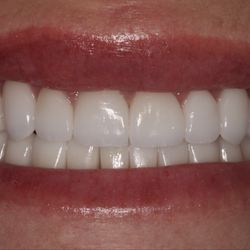 Advanced Dentistry of Amarillo