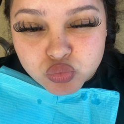 Roots Dental - Me right before my cleaning super cool shades lol
