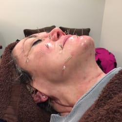 Wholistic Family Healthcare - Simeon Pollock of Wholistic Family Healthcare is now offering facial rejuvenation as a service.