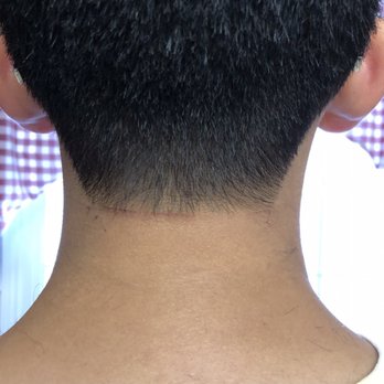 Supercuts - Dull trimmer left painful cut in back of neck - Hair Salons Near Me - Baton Rouge, Louisiana Supercuts - Dull trimmer left painful cut in back of neck - Hair Salons Near Me - Baton Rouge, Louisiana