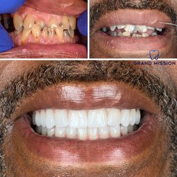 Grand Mission Dentistry Of Richmond - Dental implants used to create patients new smile