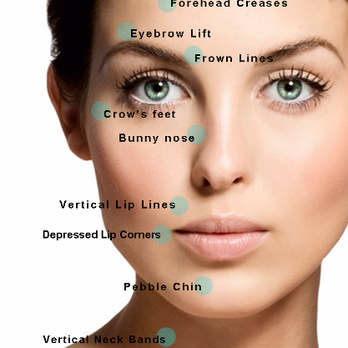 Rhoad To Beauty - What can Botox or Dysport do for you? All injections by Dr. Rhoad, board-certified female plastic surgeon. #nomorewrinles #smoothskin - Medical Spas Near Me - Austin, Texas Rhoad To Beauty - What can Botox or Dysport do for you? All injections by Dr. Rhoad, board-certified female plastic surgeon. #nomorewrinles #smoothskin - Medical Spas Near Me - Austin, Texas