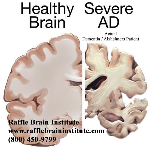 Raffle Brain Institute - grief counselor in Carmel, IN