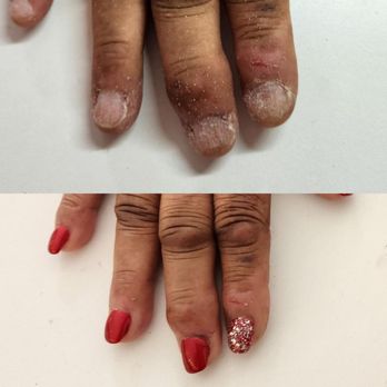 Midtown Day Spa - Top is the before picture. - Day Spas Near Me - Baltimore, Maryland