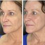 Injecting Confidence Aesthetic Medicine