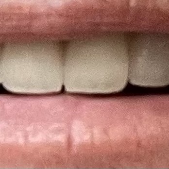 Prime Dental Care: Peter Bishay, DMD - A close-up. - General Dentistry Near Me - Orange, California