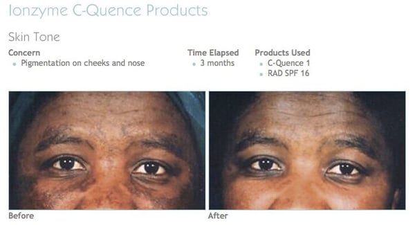 You Rejuvenated by null