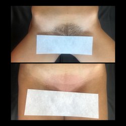 Unlocke Your Beauty Wax Lounge - Before & After Brazilian Wax