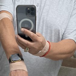 Labcorp - 3 painful attempts