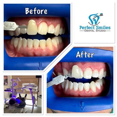 PERFECT SMILES DENTAL STUDIO - Updated February 2026 - 59 Photos & 37